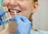 implant dentar sector 6
