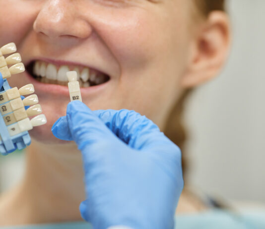 implant dentar sector 6