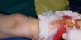 Accident oribil in localitatea Voinesti, Dambovita. Un om s-a ales cu piciorul amputat (UPDATE)