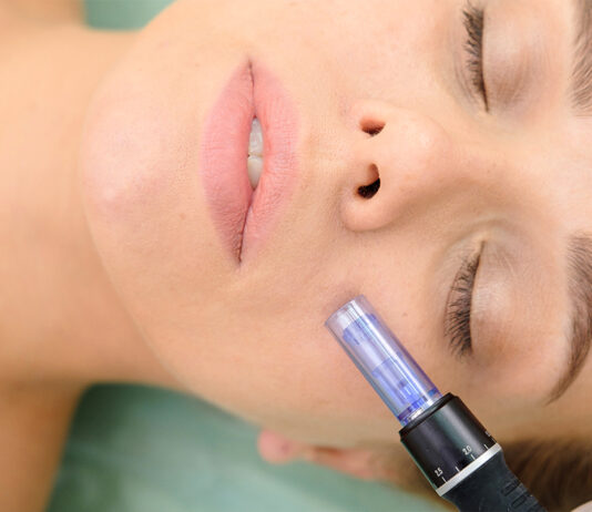 Tratamentele dermatologice cu Dermapen – Ziarul Nationalul