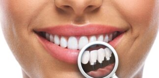 Implantul dentar fast & fixed – principala opțiune pentru înlocuirea dinților lipsă
