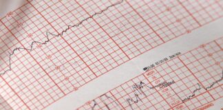 Ecocardiografia – când se recomandă și ce presupune