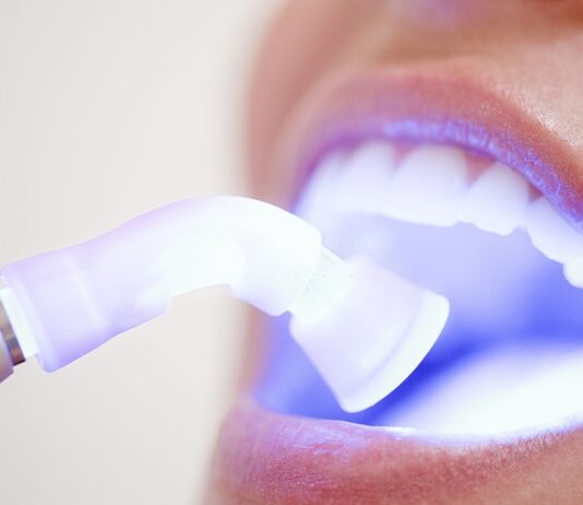 Avantajele laserului dentar in tratamentele stomatologice