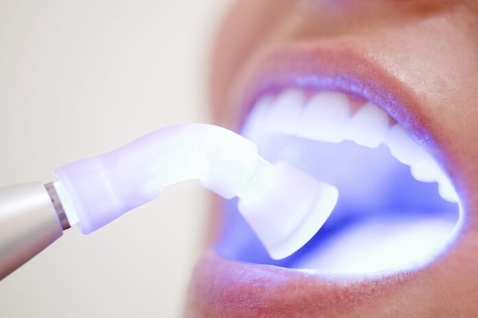 laser dentar Alexandria