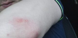 Seful Poliției Anina și-a permis să râdă de doi subalterni de-ai săi când a aflat că au fost ultragiați de un șofer aflat în stare de ebrietate – Ziarul Incisiv de Prahova