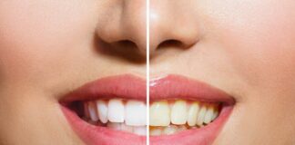 estetica dentara premium