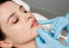 Injectări acid hialuronic: pentru buze mai mari, așa cum ți le-ai dorit mereu