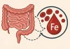 Legătura dintre intestin și deficitul de fier: Anemia prezentă chiar și cu o dietă adecvată