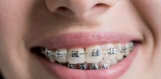 Descopera care este importanta tratamentelor ortodontice pentru sanatatea orala